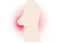 Genetički test za rak dojke za 1000 kn i 24 sata uskoro na Institutu Ruđer Bošković breast g9b33f15a5 640 Genetičko testiranje radi prevencije raka dojke