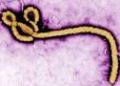 Ebola virus