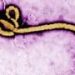 EBOLA: 10 osnovnih činjenica koje treba znati o ovoj opasnoj zaraznoj bolesti ebola Ebola virus