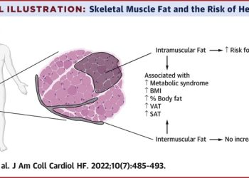 Ultraprocesuirana hrana dovodi do povećanja masti u mišićima Intramuskularna masnoca bedrenog misica povezana je s povecanim rizikom srcanog zatajenja Iz istraživanja Association Between Thigh Muscle Fat Infiltration and Incident Heart Failure: The Health ABC Study: Intramuskularna masnoća bedrenih mišića povezana je s većim rizikom zatajenja srca